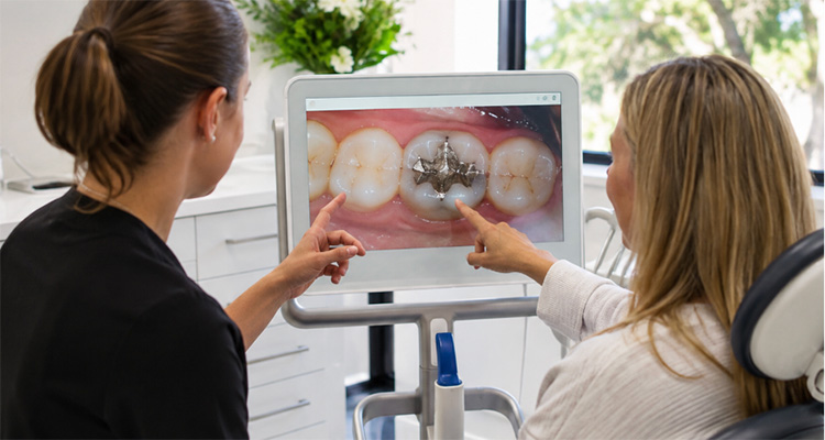 old-filling-dentist-richmond